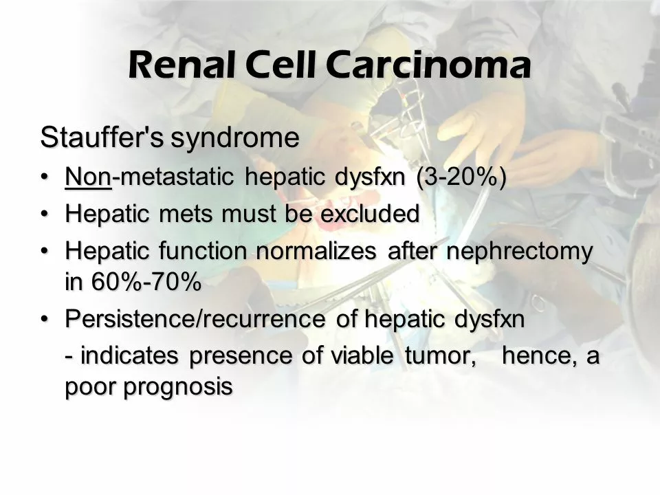 The Connection Between Renal Cell Carcinoma and Kidney Transplants